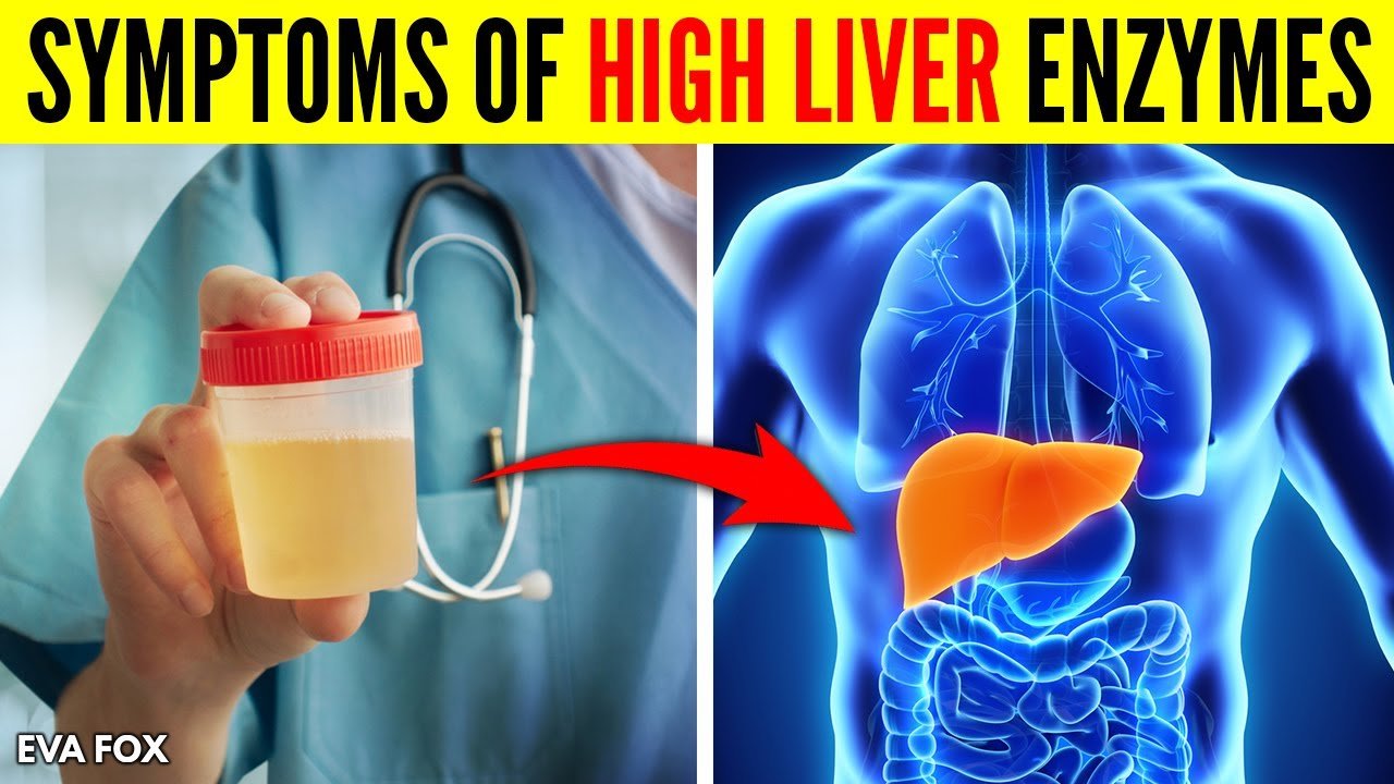 signs-and-symptoms-of-high-liver-enzymes-causes-and-treatment-healthy